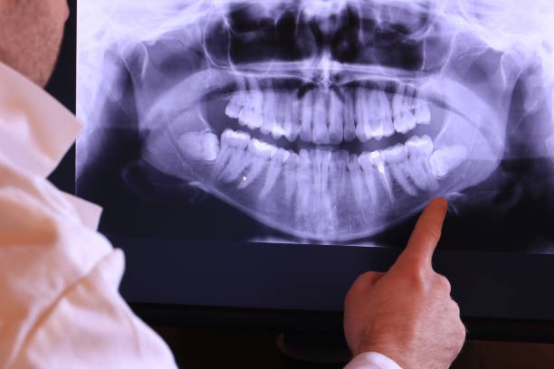 Best Emergency Dental Care for Broken or Chipped Teeth in Centennial Park, AZ
